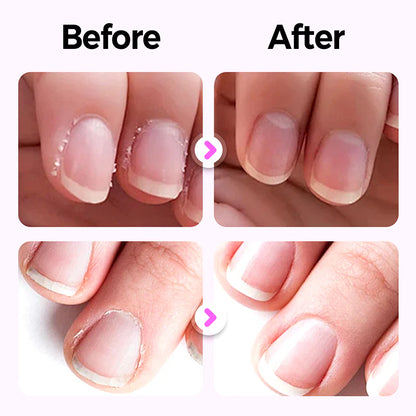 Nail Armor Essence Pen — Cuticle Repair & Moisturizing【Kupite 1 dobite 1 brezplačno】