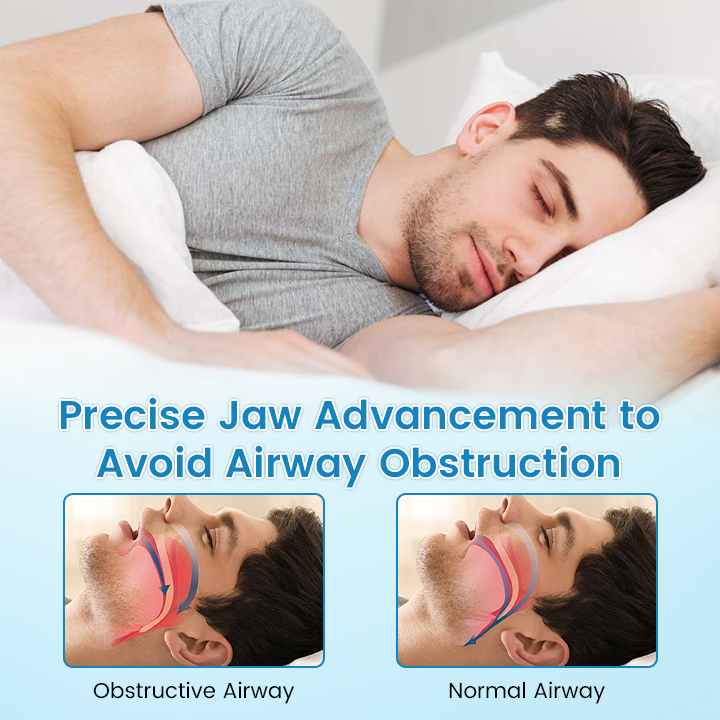😴Rešilec spanja🔥1+1 gratis😪 Ustnik proti smrčanju – alternativa CPAP/MAD – 180-dnevno jamstvo!