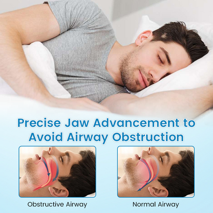 😴Rešilec spanja🔥1+1 gratis😪 Ustnik proti smrčanju – alternativa CPAP/MAD – 180-dnevno jamstvo!
